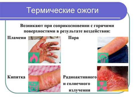 Механизм воздействия биологического агента при повреждениях кожи