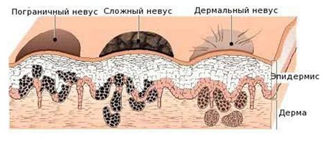 Моли и родинки в пупке: определение и классификация