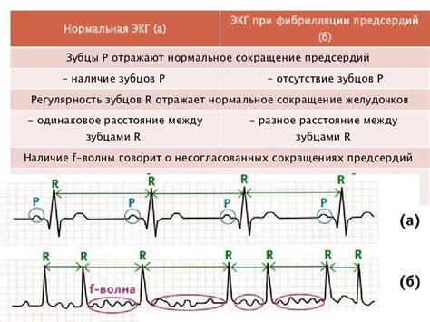 НЖЭС в кардиологии: сущность и норма