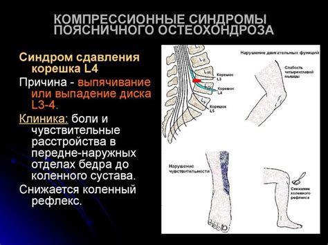 Неврологические проявления грыжи позвоночника и их последствия