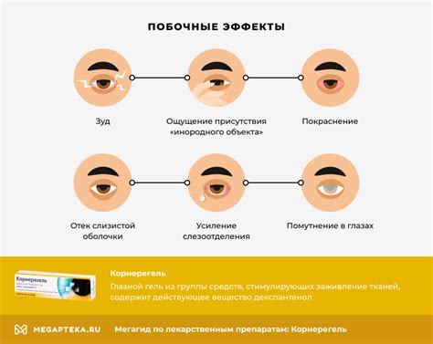 Недостатки корнерегеля