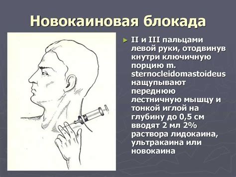 Недостатки новокаиновой блокады