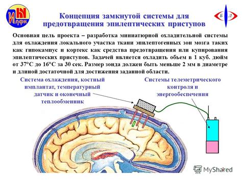 Новые достижения в применении лекарств для контроля эпилептических приступов у кошек