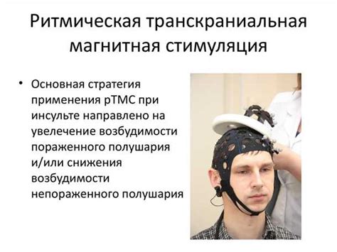 Новые перспективы в лечении эпилепсии: использование генной терапии
