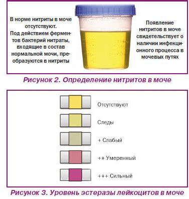 Нормы и отклонения в анализе суточной мочи: сигналы о состоянии здоровья