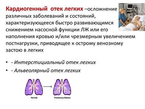 Общие признаки отека легких: основные симптомы