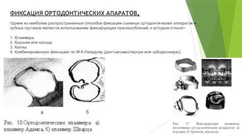 Ожидаемые результаты от проведения массажной процедуры при наличии ортодонтических апаратов