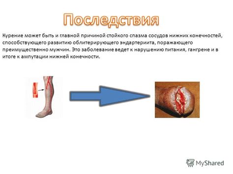 Ожирение в качестве фактора, способствующего развитию патологии нижних конечностей