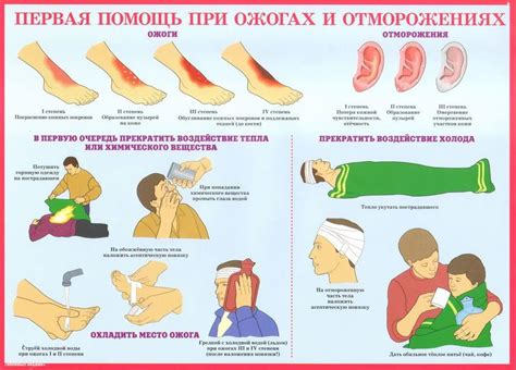 Оказание помощи при случаях сотрясения у грудничков