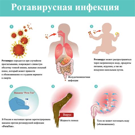 Опасная инфекция: сифилис и его пути передачи