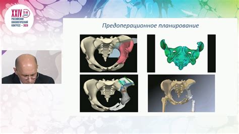 Опасности и осложнения при хирургическом удалении жировых отложений по всему телу