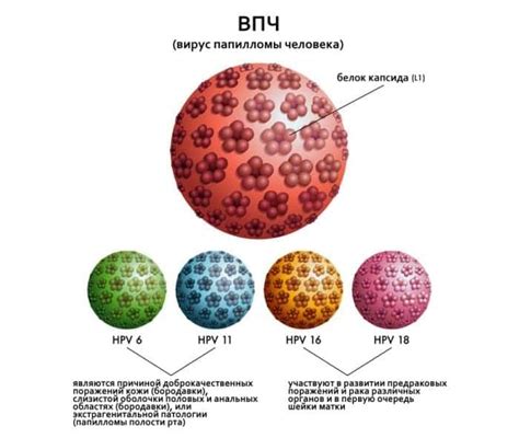 Описание проявлений и признаков ВПЧ 11 типа