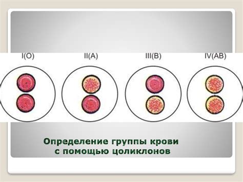 Определение группы крови и правильная отражение в медицинских документах