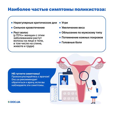 Опыт женщин с поликистозом яичников в достижении беременности