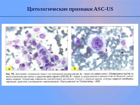 Организация клеток в слоях плоского эпителия