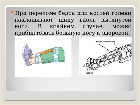 Осложнения, ведущие к повышению температуры при переломе