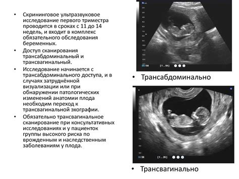 Основные аспекты трисомии 21 в первом триместре беременности