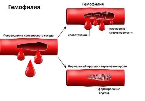 Основные достоинства и значимость пожертвования крови