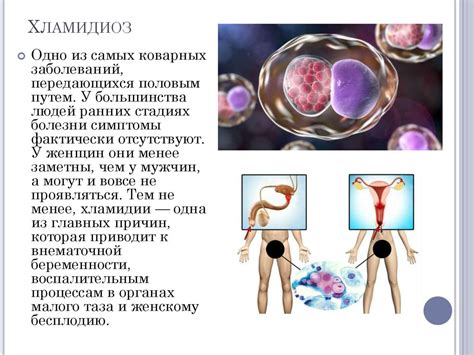 Основные инфекции, передающиеся половым путем, и способы их передачи