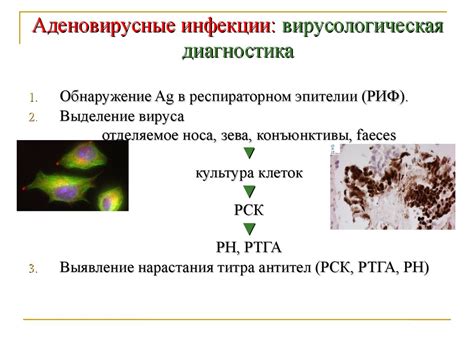 Основные методы диагностики вирусных инфекций