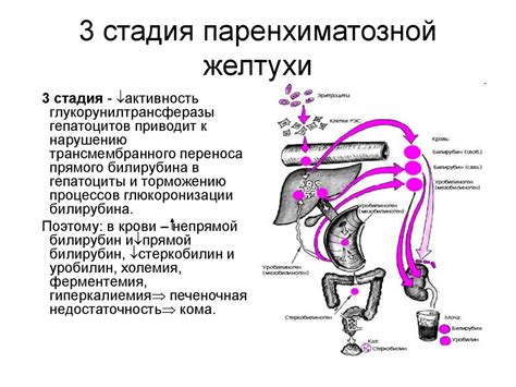 Основные методы предупреждения желтухи: рекомендации и советы