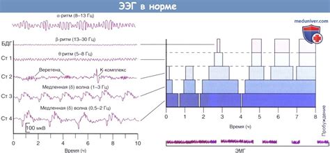 Основные преимущества проведения электроэнцефалограммы в столице Беларуси