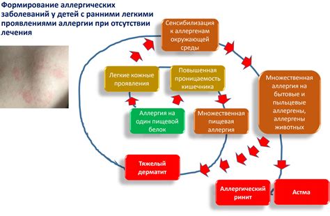 Основные признаки аллергии и их влияние на повседневную жизнь