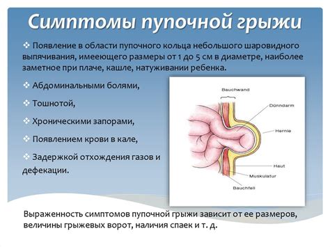 Основные признаки и симптомы пупочной грыжи