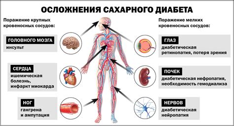 Основные признаки сахарного диабета 2 типа у молодых людей