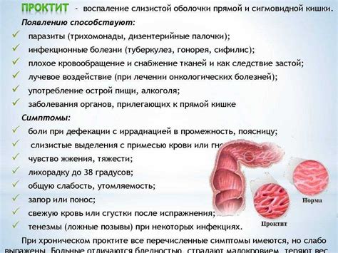 Основные принципы терапии хронического воспаления прямой и сигмовидной кишок 