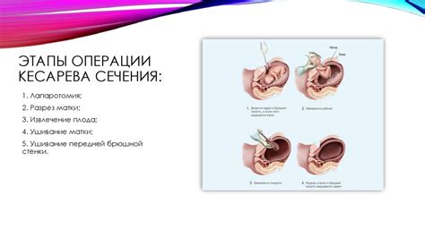 Основные причины и индикации для проведения операции кесарева сечения