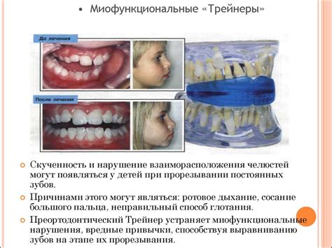 Основные способы коррекции зубных аномалий и их особенности