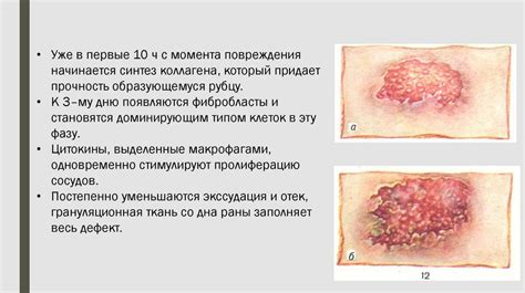 Основные факторы, влияющие на скорость регенерации раны после хирургического вмешательства