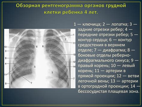 Особенности проведения рентгенограммы в Костроме