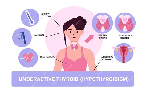 Особенности проявления недостаточной деятельности щитовидной железы