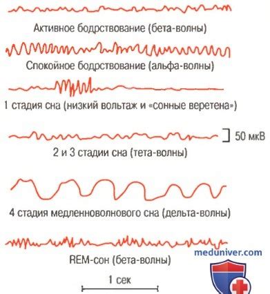 Особенности сна и периоды активности у ахатин