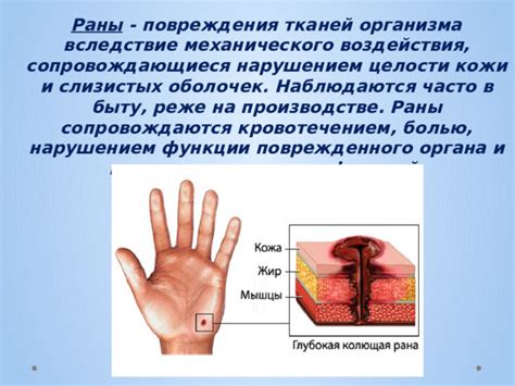 Особенности этапа развития раны, когда в ней наблюдаются признаки гноения и некроза тканей