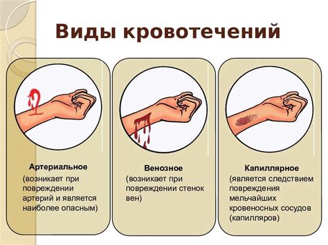 Остановка кровотечения из уха при остром отите: эффективные методы и советы