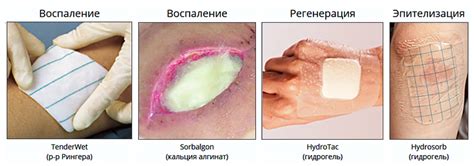 Очистите рану и произведите сухое обезболивание