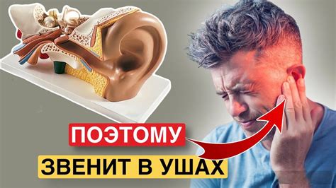 Ощущение звуков и шумов в ушах и в голове