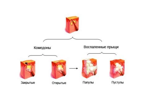 Папулы и пустулы