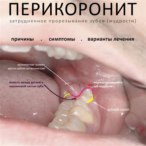 Переход на новый рацион: причины, важность и последствия операции