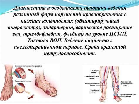 Пиявки - природное средство для стимуляции кровообращения в нижних конечностях