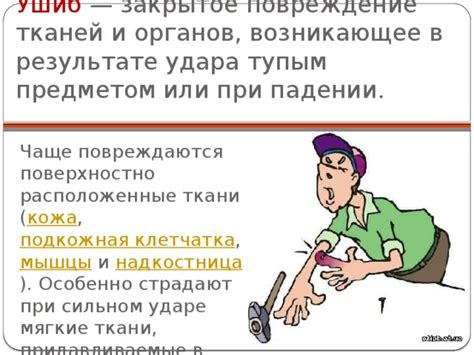 Повреждение шкива в результате удара или перегрузки
