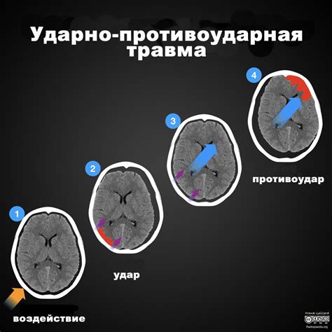 Повреждение электронной и механической оборудования