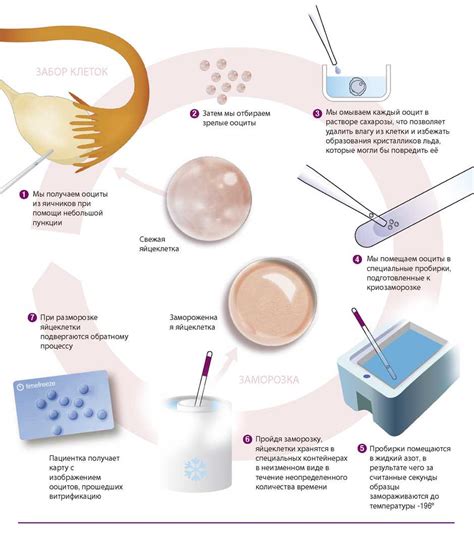 Подготовка к ЭКО для улучшения качества ооцитов