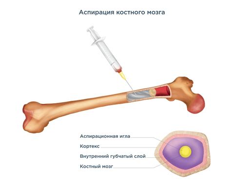 Подготовка к процедуре извлечения клеток костного мозга: важность и этапы