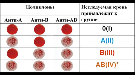 Поддержка и методы лечения при взаимодействии негативного резус-фактора с различными группами крови