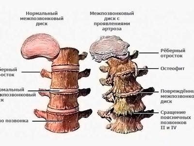 Подходы к поддержке поясничного отдела позвоночника: особенности и принципы действия