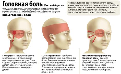 Попытка облегчить симптомы головной боли и мигрени